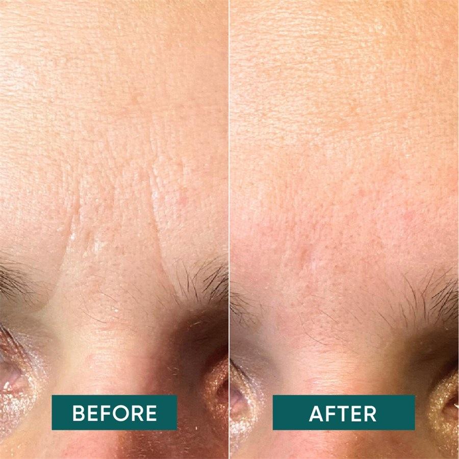 Gesicht Facial Patches Niacinamide - it’s a skin-vestment von APRICOT Begrenzte Freigabe