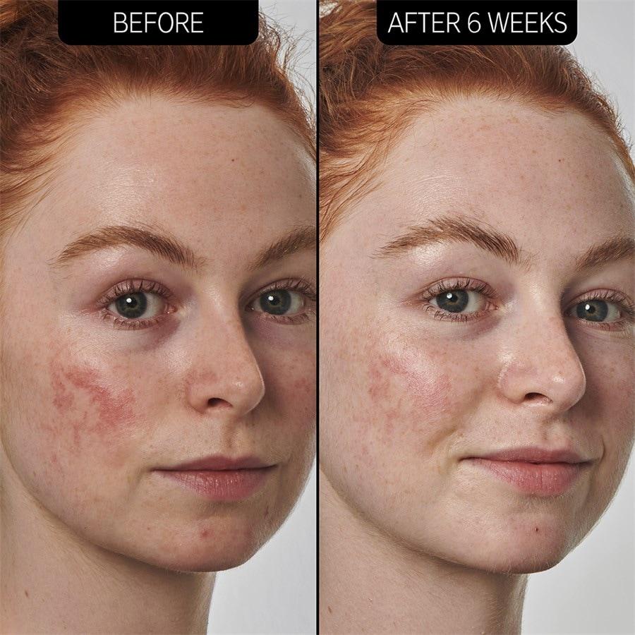 Seren SuperSolutions 10% Azelaic Acid Serum von The INKEY List im Angebot