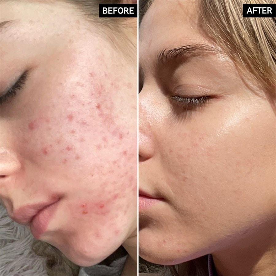 Seren Niacinamide Serum von The INKEY List Begrenzte Freigabe