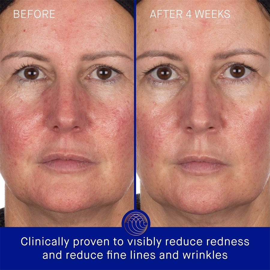 Gesicht Hydrogel Face Mask von Augustinus Bader 2025