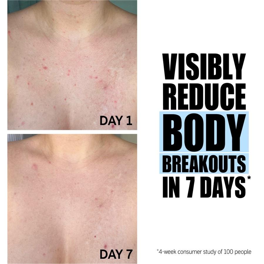 Peeling Glycolic Acid Exfoliating Body Stick von The INKEY List Fabrikladen