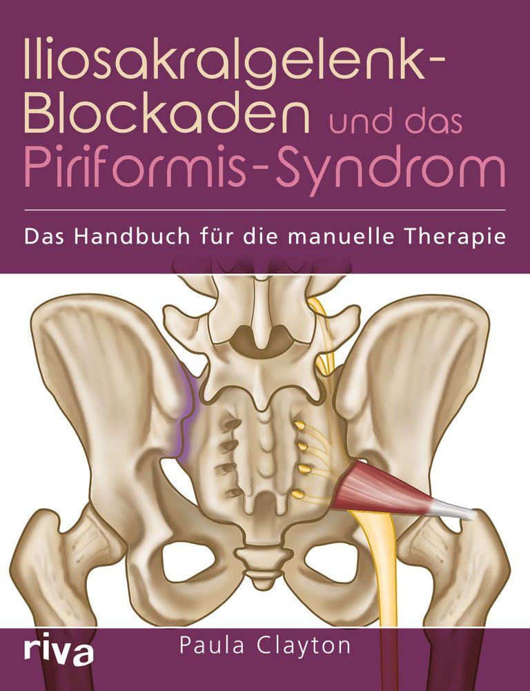 shopapotheke Iliosakralgelenk-Blockaden und das Piriformis-Syndrom