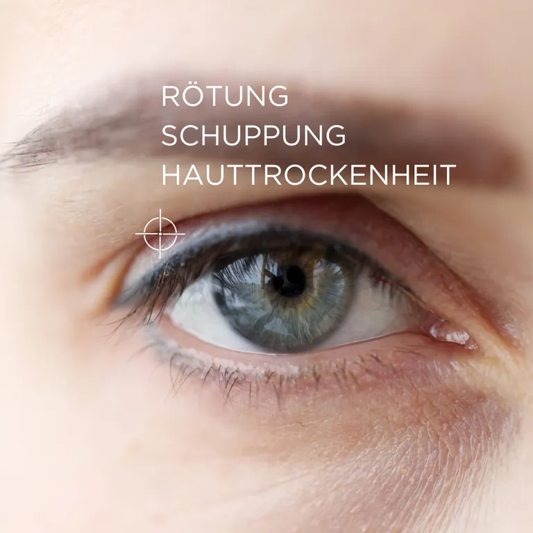 shopapotheke ALLERGIKA® Augenlidcreme MED - Jetzt 2€ sparen mit Code "allmed2" Günstiger Verkauf