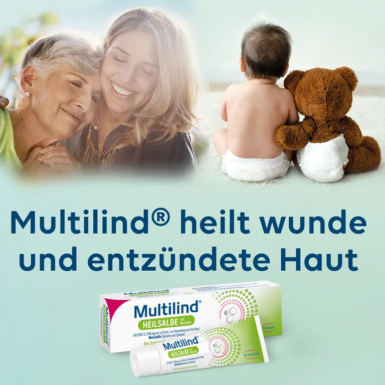 shopapotheke Multilind® Heilsalbe bei wunder und entzündeter Haut mit Zinkoxid und Nystatin - Jetzt 20% mit dem Code stada20 sparen* Outlet
