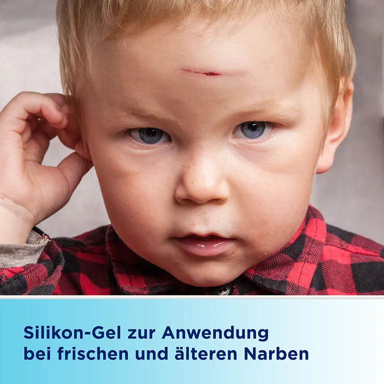 shopapotheke Bepanthen® Narben-Gel mit Massage-Roller Blitzverkäufe
