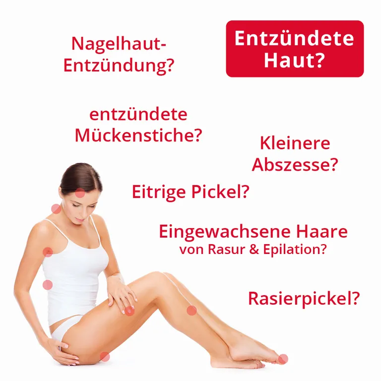 shopapotheke ilon® Salbe classic bei Entzündungen der Haut Fabrikpreis