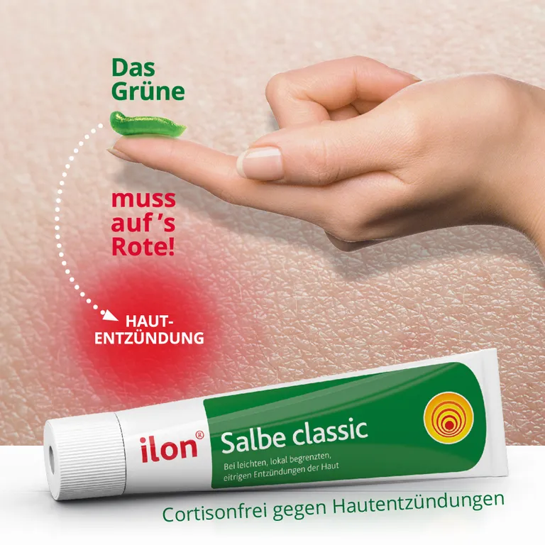 shopapotheke ilon® Salbe classic bei Entzündungen der Haut Fabrikpreis