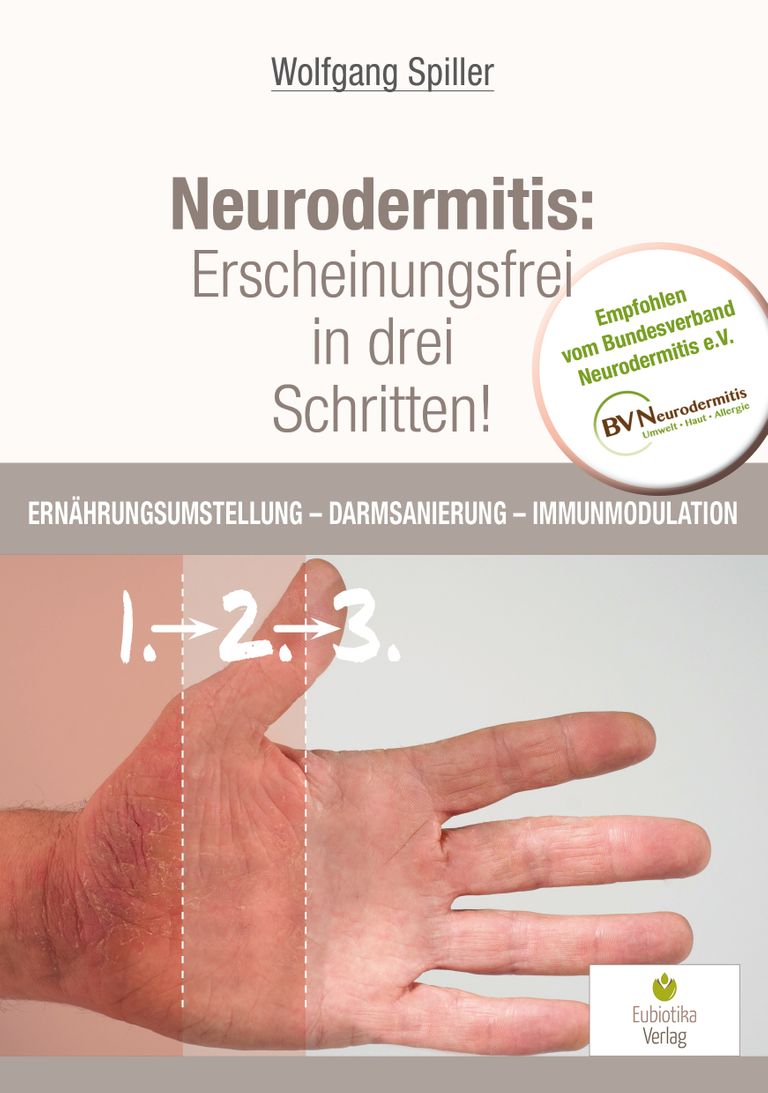 shopapotheke Neurodermitis: Erscheinungsfrei in drei Schritten Wochenangebot
