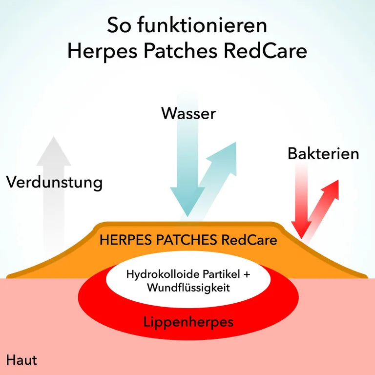shopapotheke Redcare Herpes Patches Letzter Tag