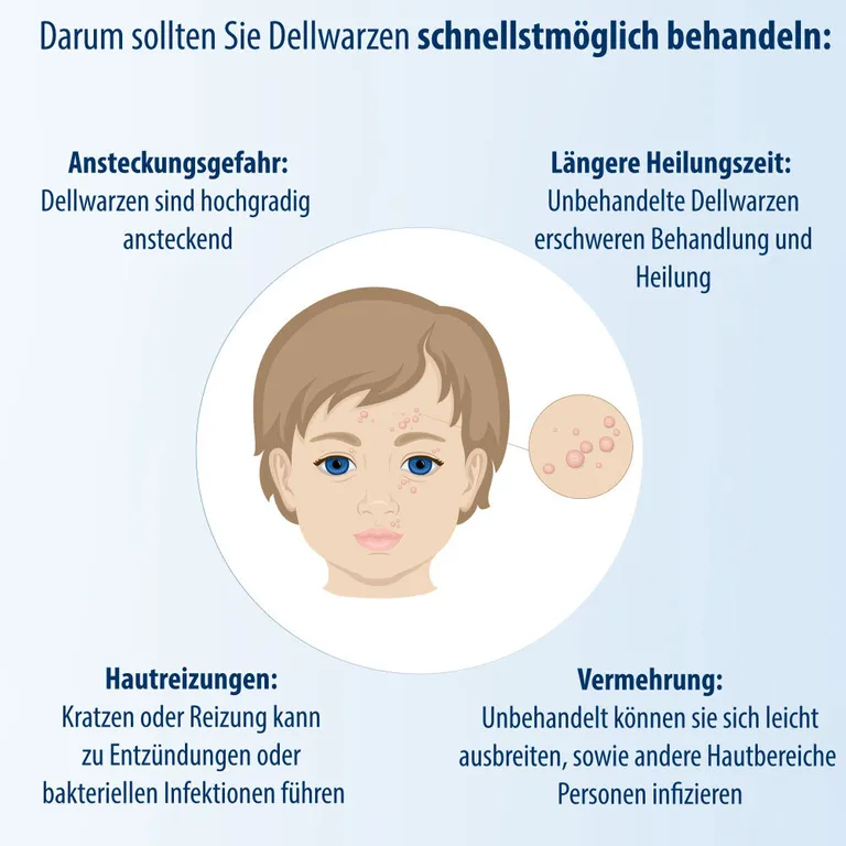 shopapotheke Evolsin® Dellwarzen Mittel I Für Erwachsene & Kinder ab 2 Jahren I Dellwarzen Behandlung mit Ätzkali Osterangebot