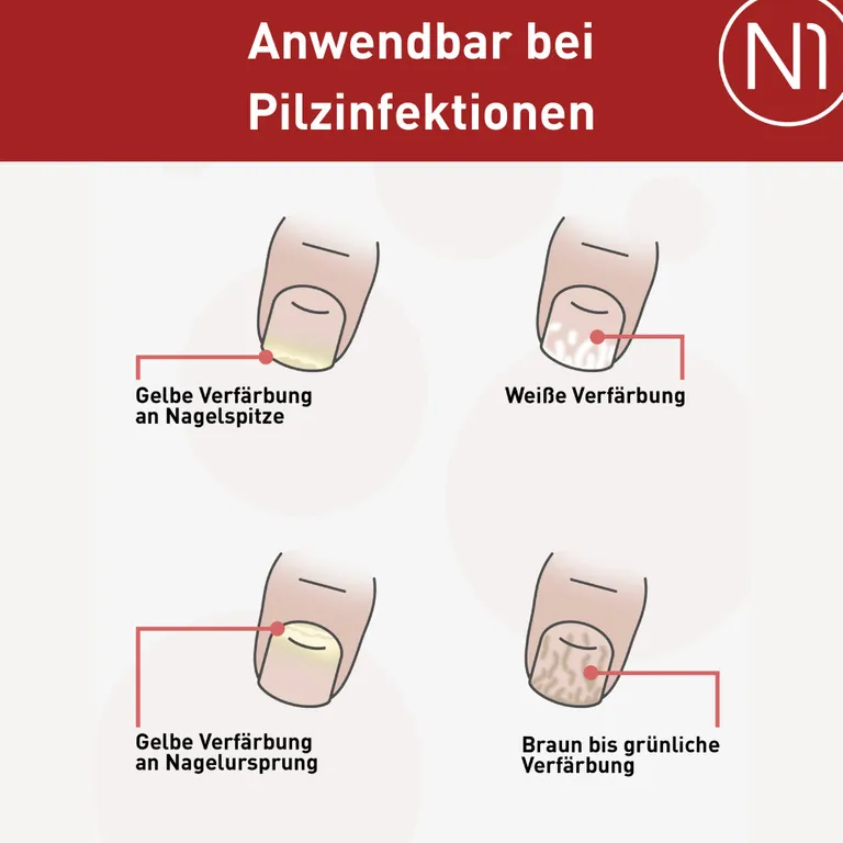 shopapotheke N1 Nagelpilz Lösung effektive Monatskur VIP-Rabatte