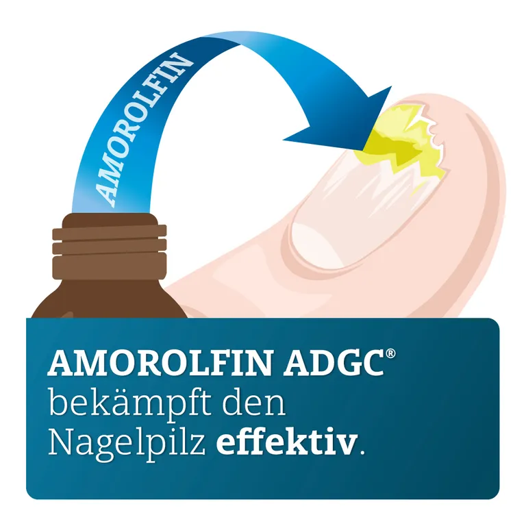 shopapotheke AMOROLFIN ADGC® wirkstoffhaltiger Nagellack gegen Nagelpilz inkl. Set Im Verkauf