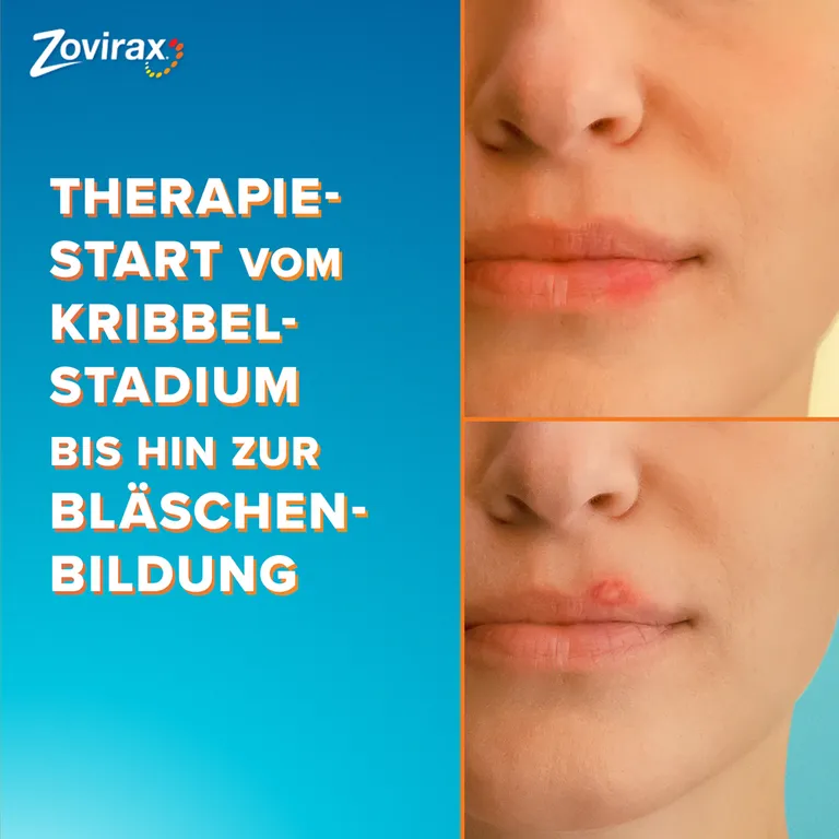 shopapotheke Zovirax Lippenherpescreme. 5 % Aciclovir. 2 g Packung Rabatte dieses Monats