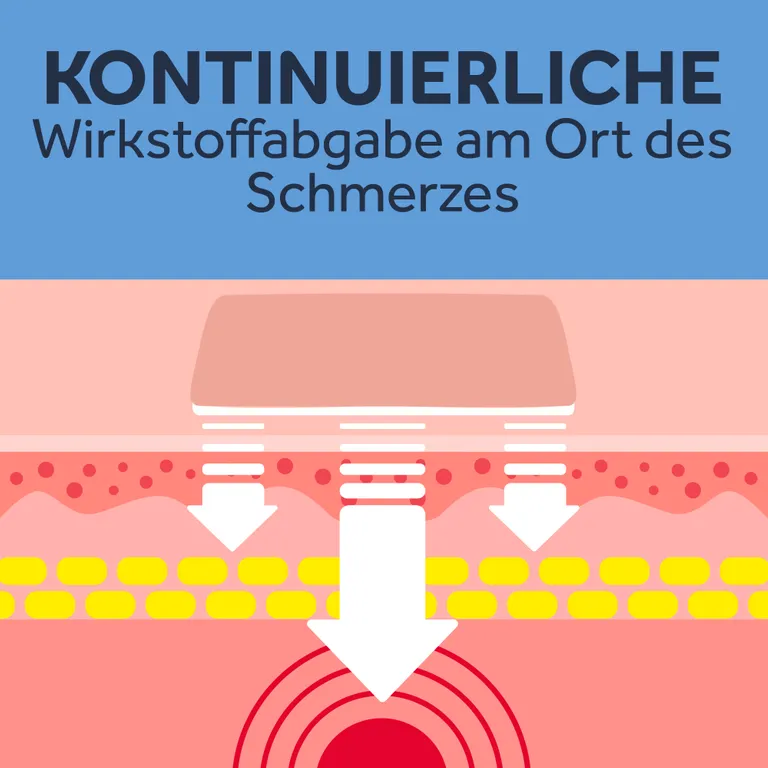 shopapotheke NUROFEN® 24-Stunden Schmerzpflaster Flash Sale