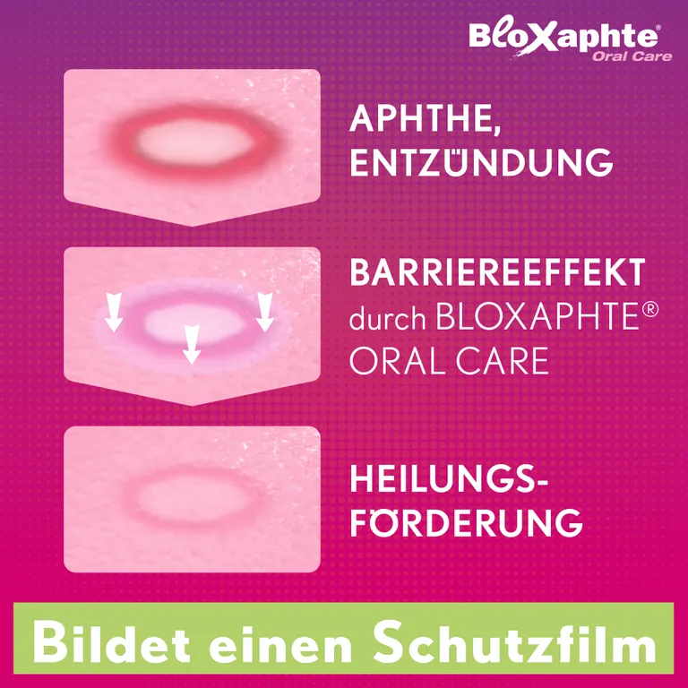 shopapotheke BloXaphte® Oral Care Mund-Gel Meist gekauft